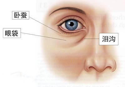 网友问上海祛眼袋医院哪家好?推荐这几家做去眼袋比较好!